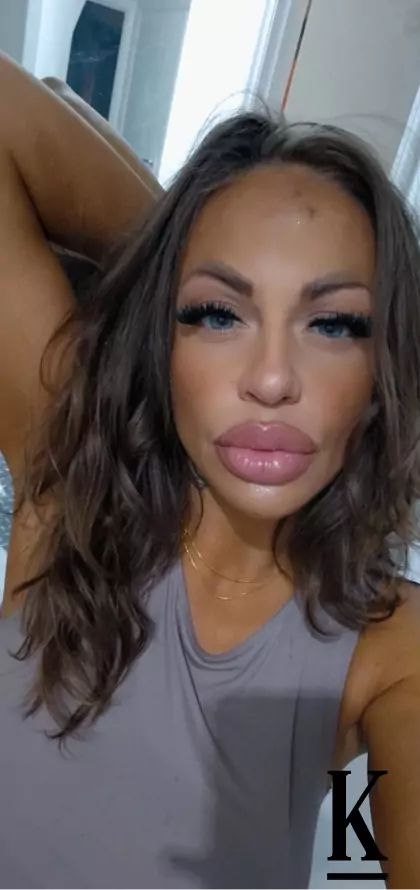 stories-slider-content