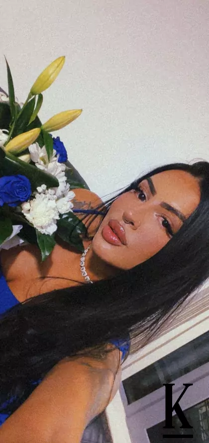 stories-slider-content