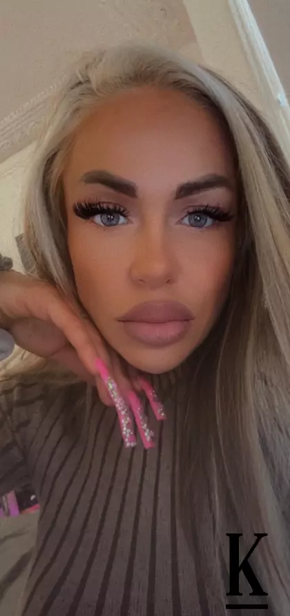 stories-slider-content