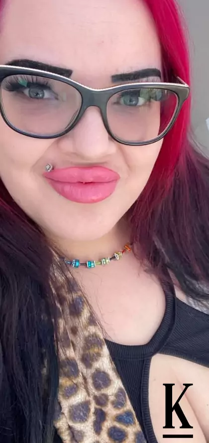 stories-slider-content