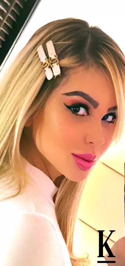 stories-slider-content