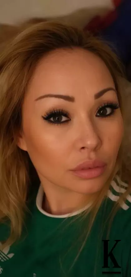 stories-slider-content