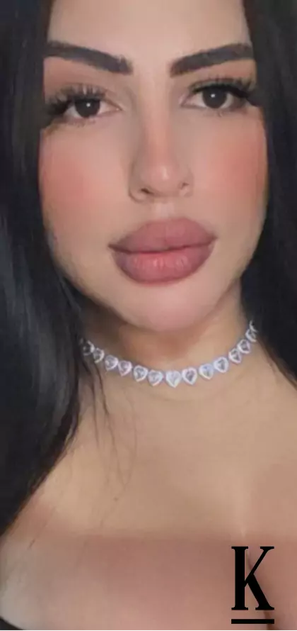 stories-slider-content