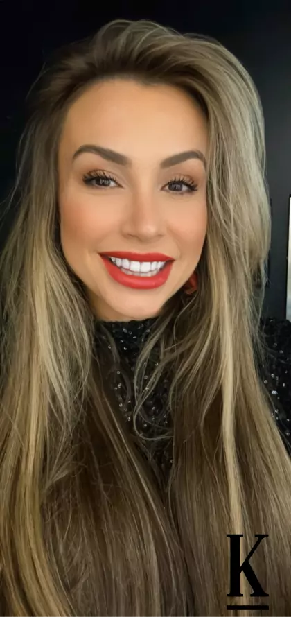 stories-slider-content