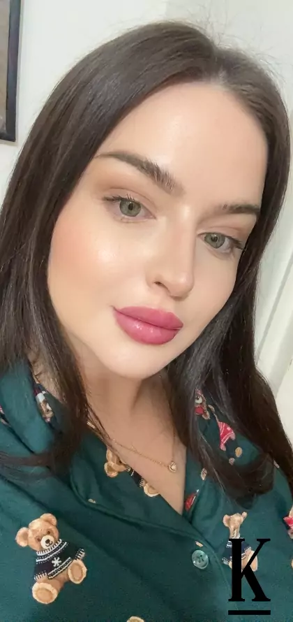 stories-slider-content