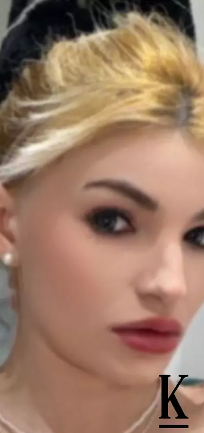 stories-slider-content